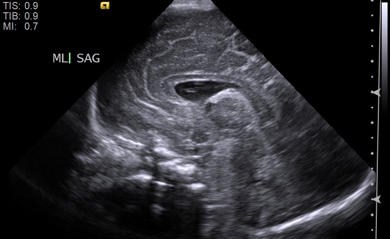 Ultrasound Neonatal Brain Radiology Template Reports