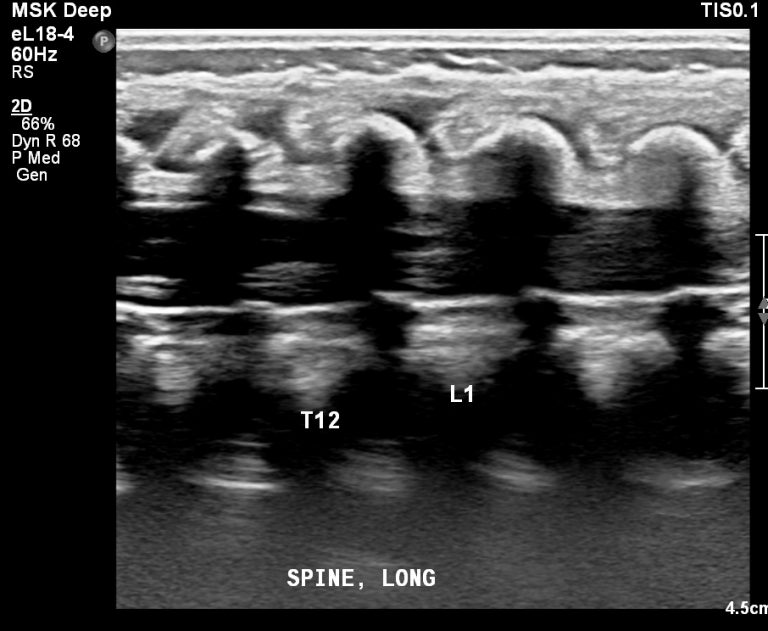 ser001img00004 Radiology Template Reports