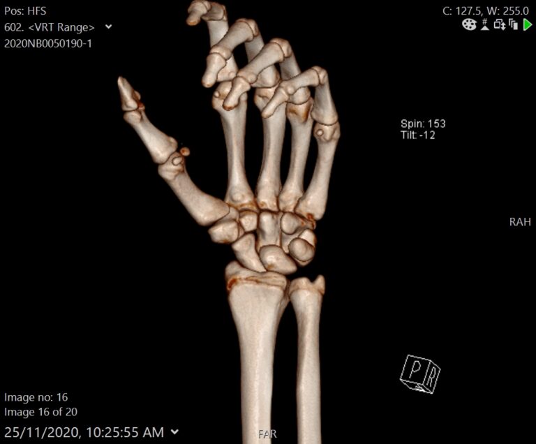 M Upper Extremity Musculoskeletal 20201125 131100 Radiology Template